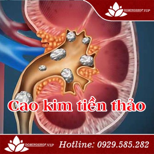 Cao kim tiền thảo, cao dược liệu cho người bị sỏi thận