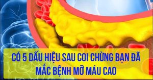 Có 5 dấu hiệu sau coi chừng bạn đã mắc bệnh mỡ máu cao