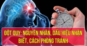 Đột quỵ: Nguyên nhân, dấu hiệu nhận biết, cách phòng tránh