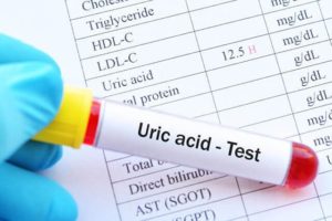 Acid uric máu là gì - các tác nhân gây tăng acid uric máu