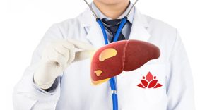 Học hỏi chế độ ăn uống đẩy lùi gan nhiễm mỡ của người Nhật