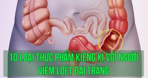 10 loại thực phẩm kiêng kị với người viêm loét đại tràng
