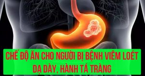 Chế độ ăn cho người bị bệnh viêm loét dạ dày, hành tá tràng