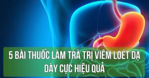 5 bài thuốc làm trà trị viêm loét dạ dày cực hiệu quả