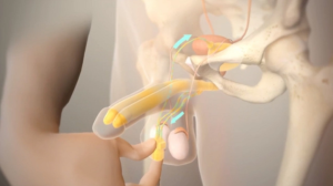 Bệnh liệt dương (ED) là tình trạng khi nam giới không thể duy trì hoặc đạt được cương cứng để thực hiện quan hệ tình dục. Đây là một vấn đề phổ biến và có thể ảnh hưởng đến sức khỏe tinh thần và mối quan hệ cá nhân.