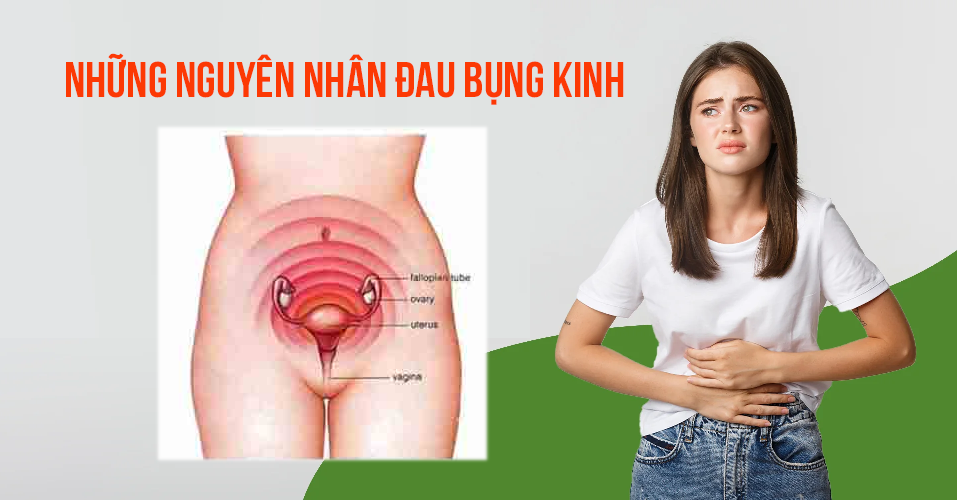 Đau bụng kinh ở phụ nữ, nguyên nhân, triệu chứng và cách phòng tránh