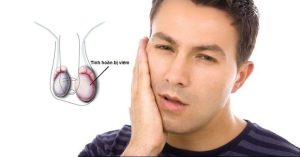 3 bài thuốc chữa vô sinh do biến chứng quai bị