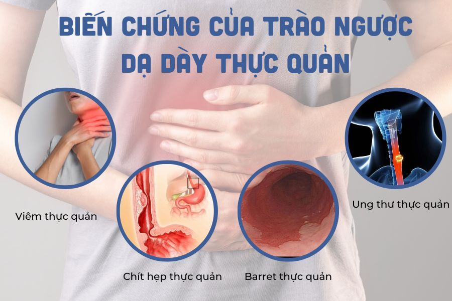 6 bài thuốc trị bệnh trào ngược dạ dày đơn giản, dễ tìm